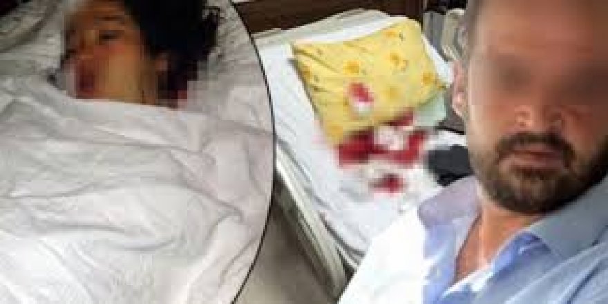 Cani koca doğum yapan eşini hastanede bıçakladı