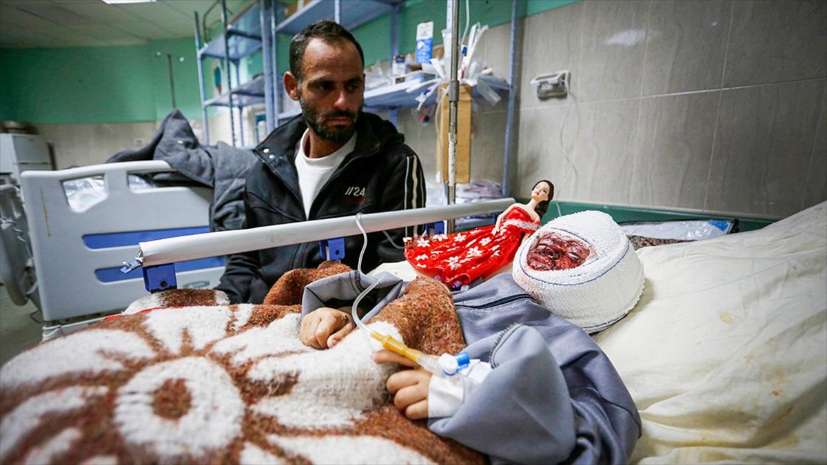 Filistinli 4 Yaşındaki Kız Çocuğu Seca, İsrail Saldırısının Acısını Yüzünde Taşıyor