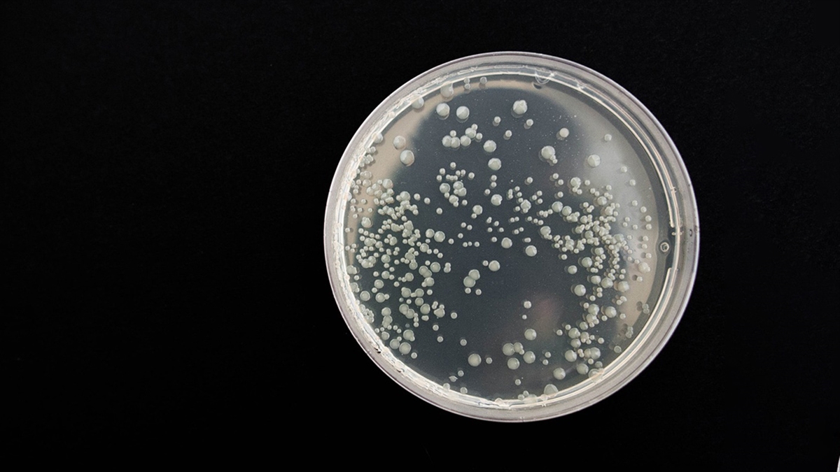 Bazı Ölümcül Bakteriler "vampir Gibi" İnsan Kanından Besleniyor