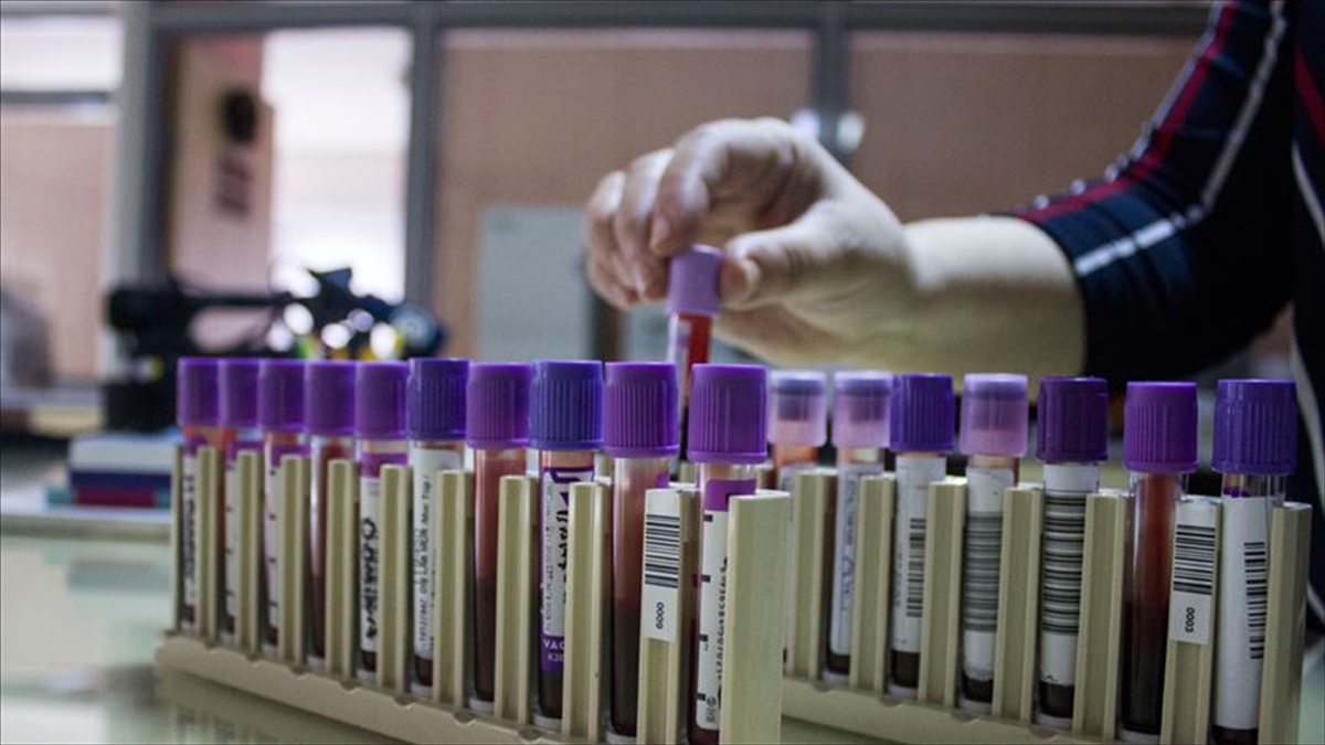 Tarama Programları Talasemiyle Mücadeleyi Kolaylaştırdı