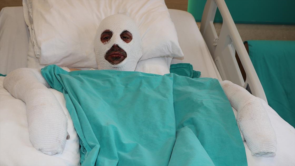 Gazı Açıp Sohbete Dalan Döner Ustası Çakmağı Çakınca Hastanelik Oldu