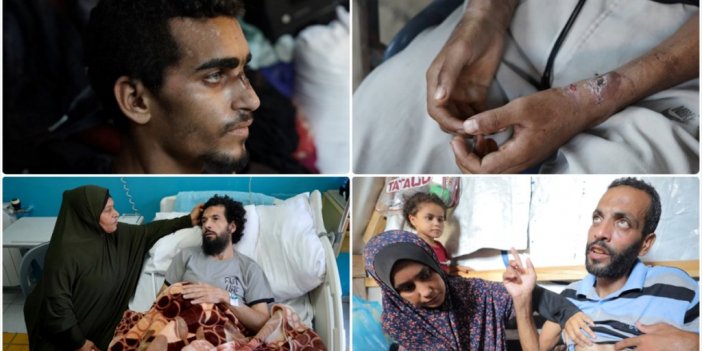 Uluslararası Af Örgütü: Filistinli Esirlere İşkence Ve Cinsel Şiddet "savaş Suçu"