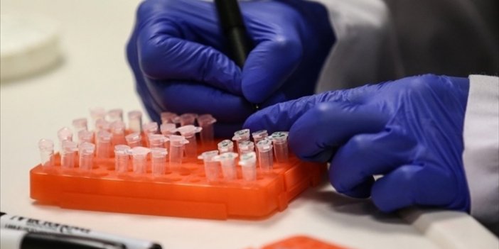 Sağlık Bakanlığı: M Çiçeği Hastalığı Vakasına Türkiye'de Rastlanmadı