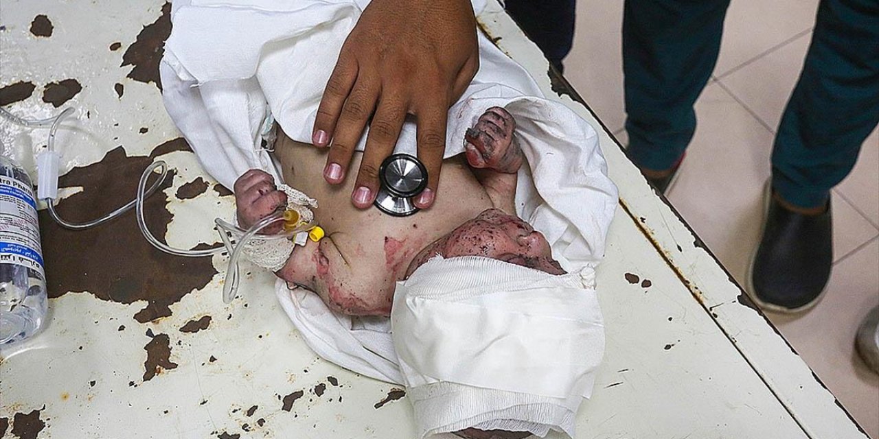 İsrail, Gazze'de 1 Yılda, Bir Yaşını Doldurmamış 786 Bebeği Öldürdü