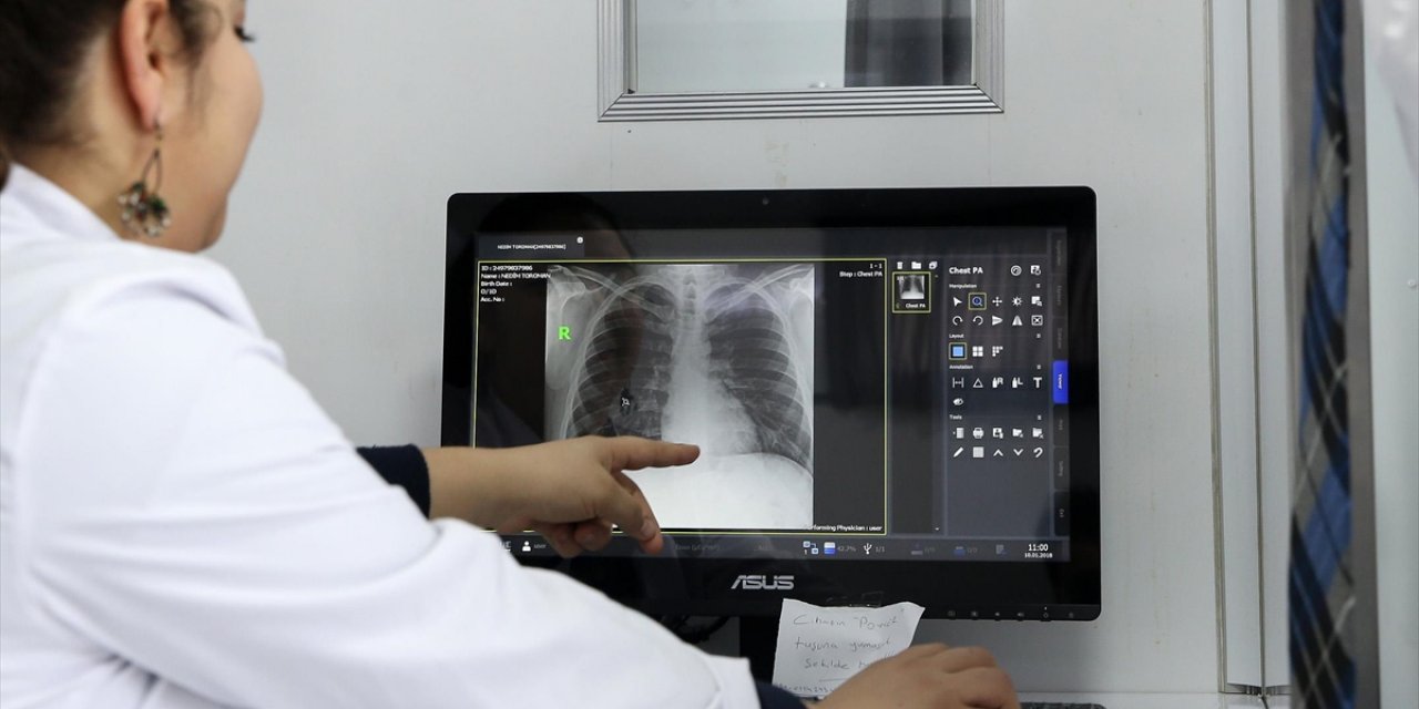 Dünya Sağlık Örgütü: 2023'te 8,2 Milyon Kişiye Tüberküloz Teşhisi Konuldu