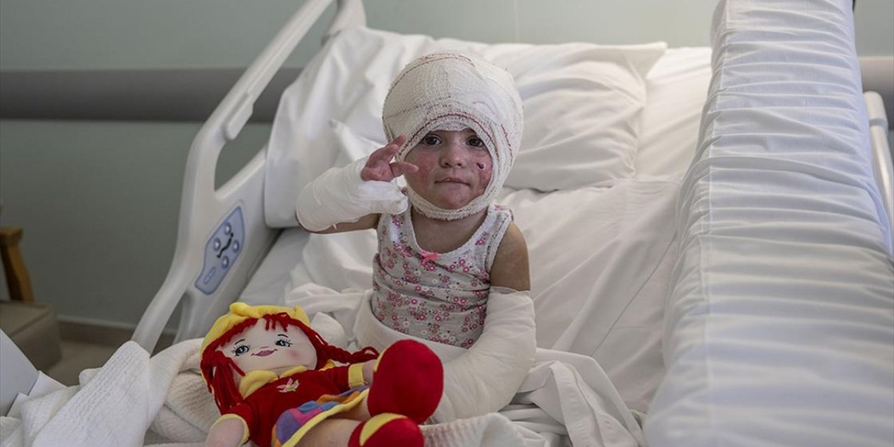 İsrail Saldırılarının Mağduru Çocuklar, Lübnan'ın Yanık Ünitesine Sahip Tek Hastanesinde Tedavi Görüyor