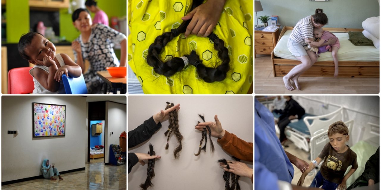 Dünyada Her Yıl 19 Yaş Altı Yaklaşık 400 Bin Çocuk Kansere Yakalanıyor