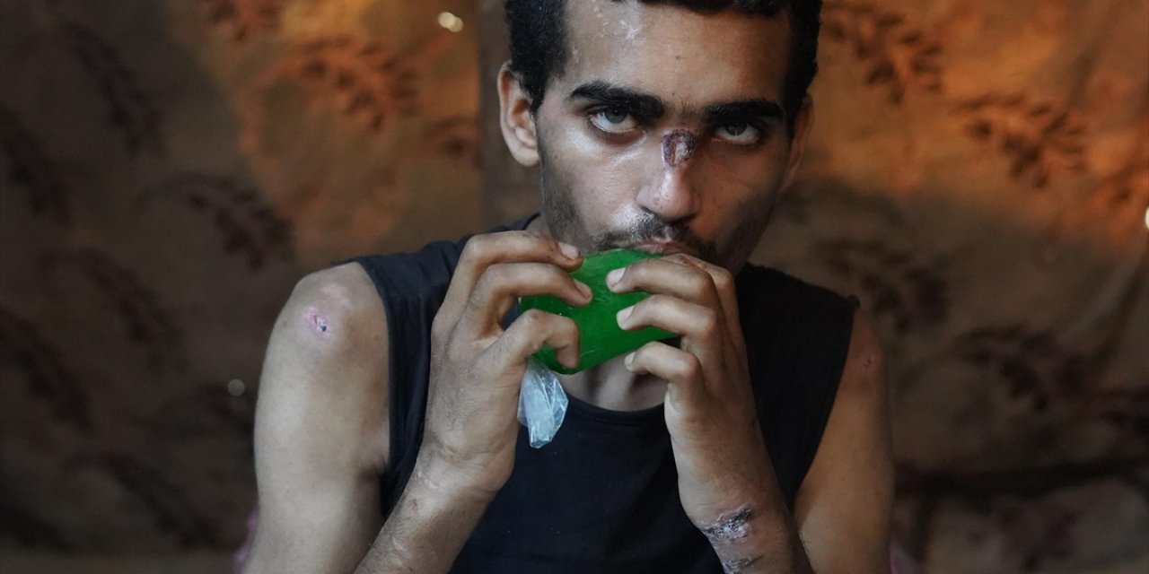 BM Raportörü, Gazze'deki Saldırıların Filistinli Siviller İçin "Tamamen Yıkıcı" Olduğunu Belirtti