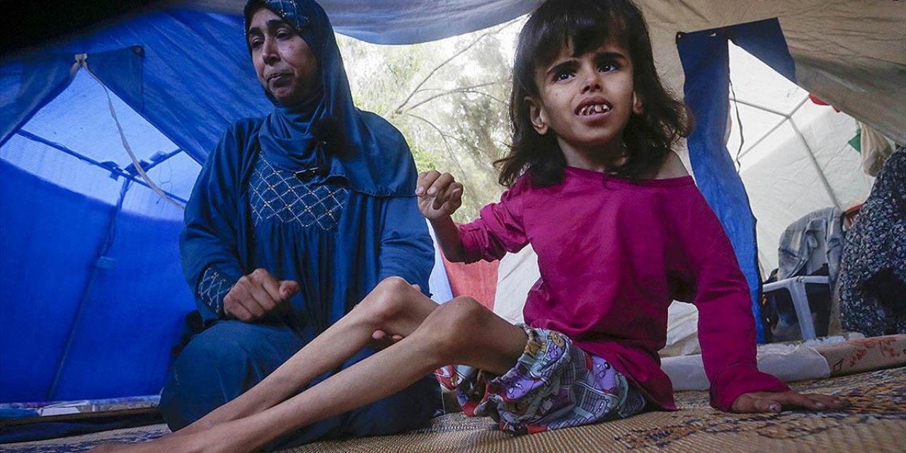 İsrail'in Gazze'deki Ölümcül Ablukası Çocukları Açlığa, Anneleri Çaresizliğe Sürüklüyor