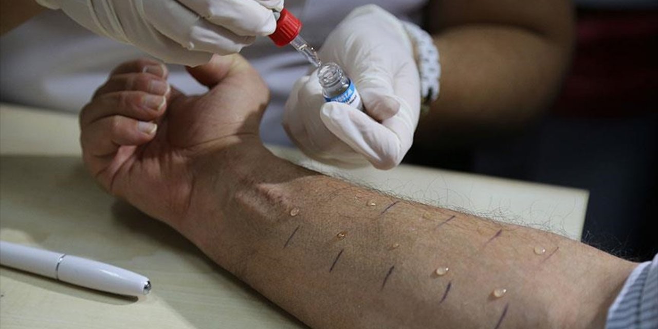 Türkiye'de Toplumun Yüzde 20'si Alerjik Belirtiler Gösteriyor