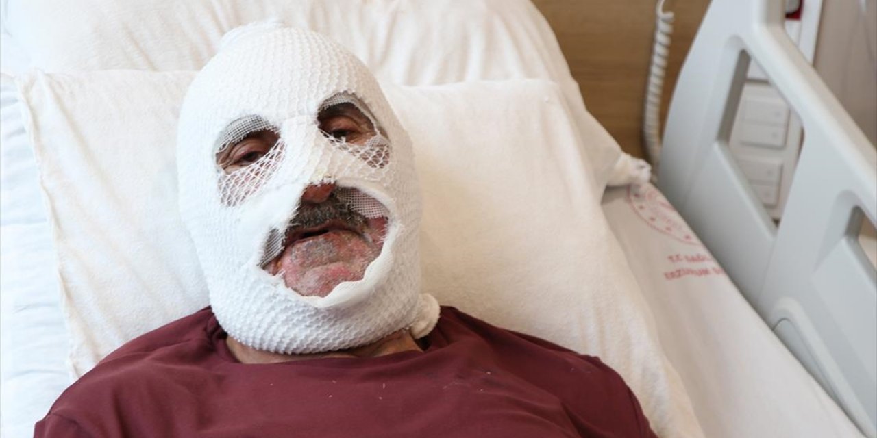 Tüpteki Gaz Kaçağını Çakmakla Kontrol Edince Hastanelik Oldu