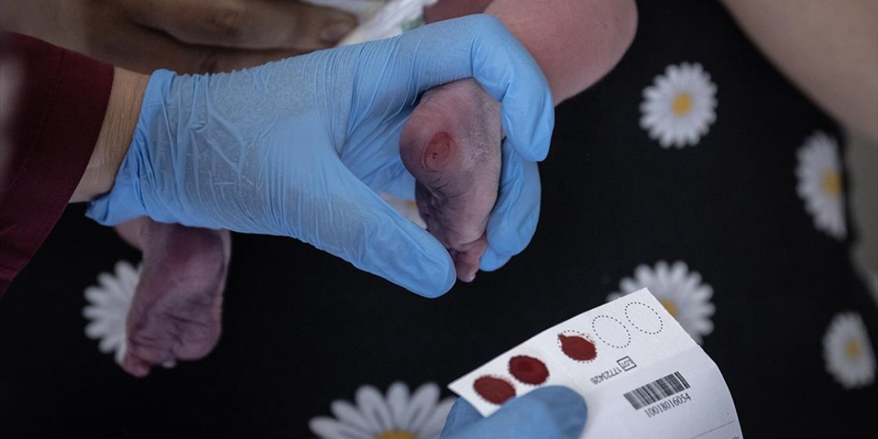 Türkiye'de Her 25 Kişiden Biri Fenilketonüri Taşıyıcısı