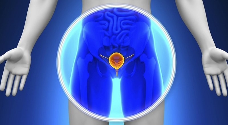 İSVEÇ'TE YAPILAN BİR ARAŞTIRMAYA GÖRE, ÜREME SAĞLIĞI TEDAVİSİ GÖREN ERKEKLERDE ''PROSTAT KANSERİ'' RİSKİ ARTIYOR