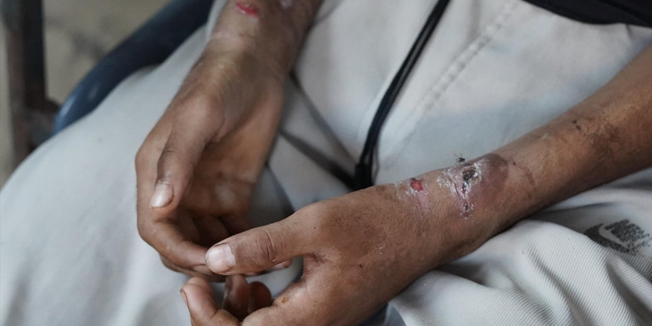 İsrailli Sağlık Çalışanı ve Askerlerden Filistinli Mahkumlara Kötü Muamele İtirafı