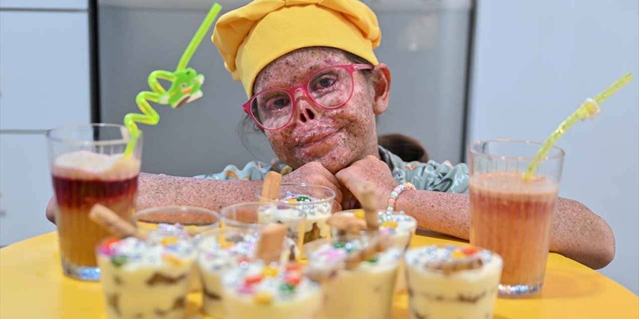 Güneşe Hasret Küçük Cemile'nin Aşçılık Hayali Gerçekleştirildi