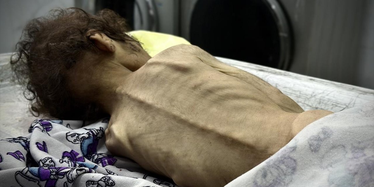 İsrail'in Kıtlığı Dayattığı Gazze Şeridi'nde Son 24 Saatte 2’si Çocuk 4 Kişi Daha Açlıktan Hayatını Kaybetti