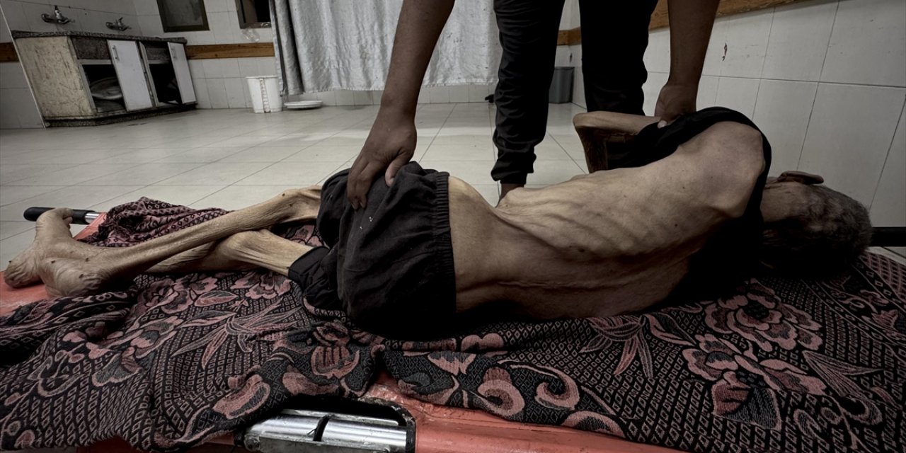 BM: Gazze'de Açlıktan Ölen İnsan Haberleri Sıradan Bir Olay Haline Geldi