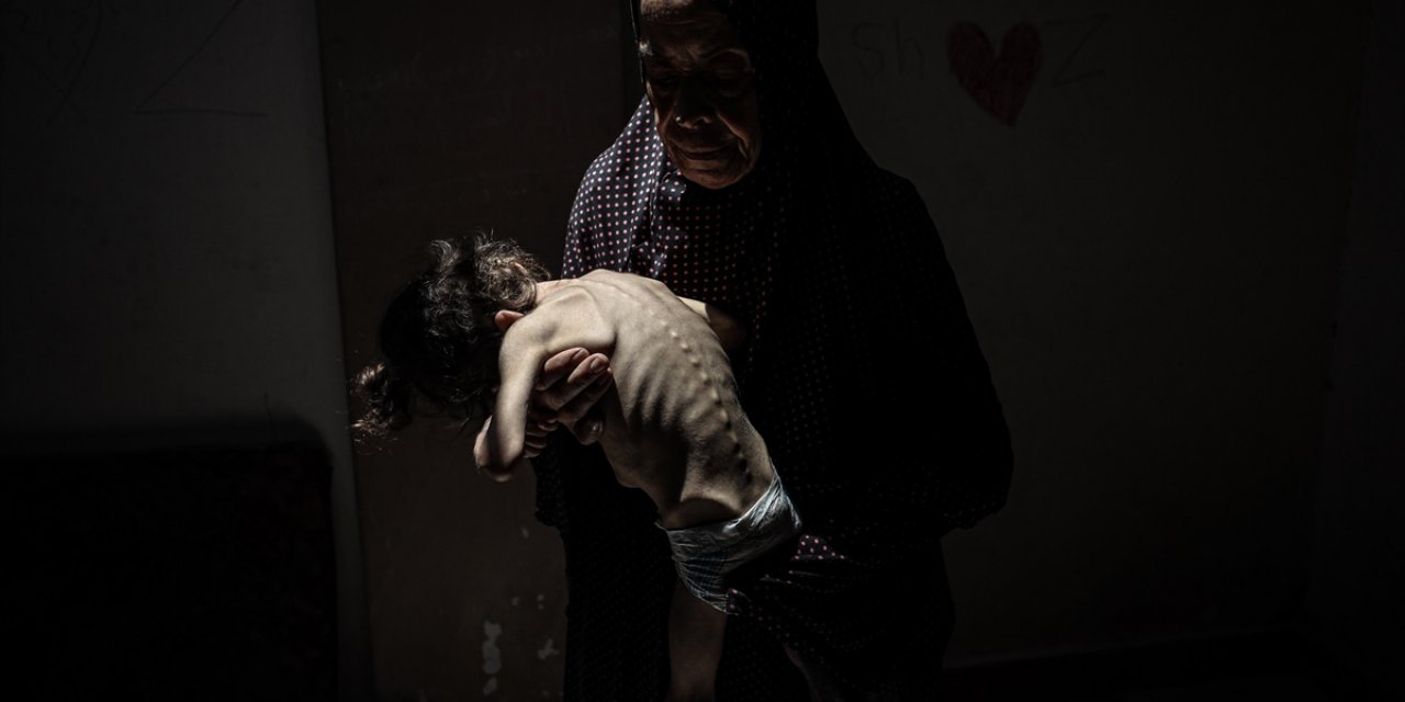 İsrail'in Kıtlığı Dayattığı Gazze'de Son 24 Saatte 4 Kişi Daha Açlıktan Hayatını Kaybetti