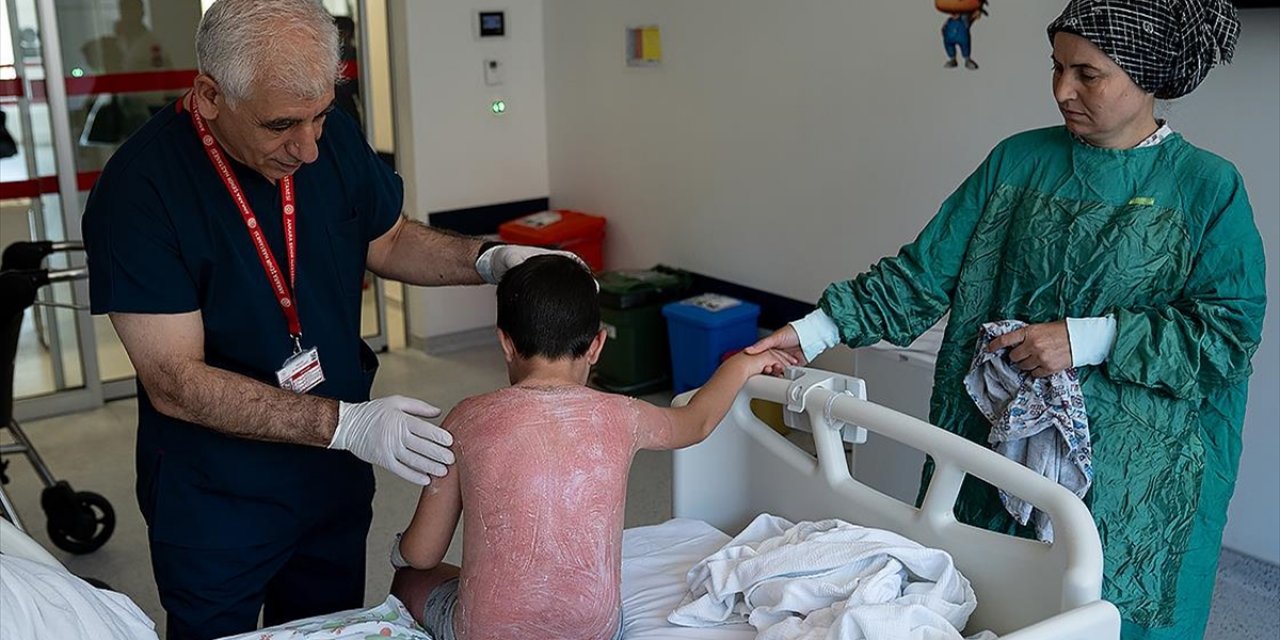 Güneşte 4 Saat Kalan Çocuk, İkinci Derece Yanıkla Hastanelik Oldu
