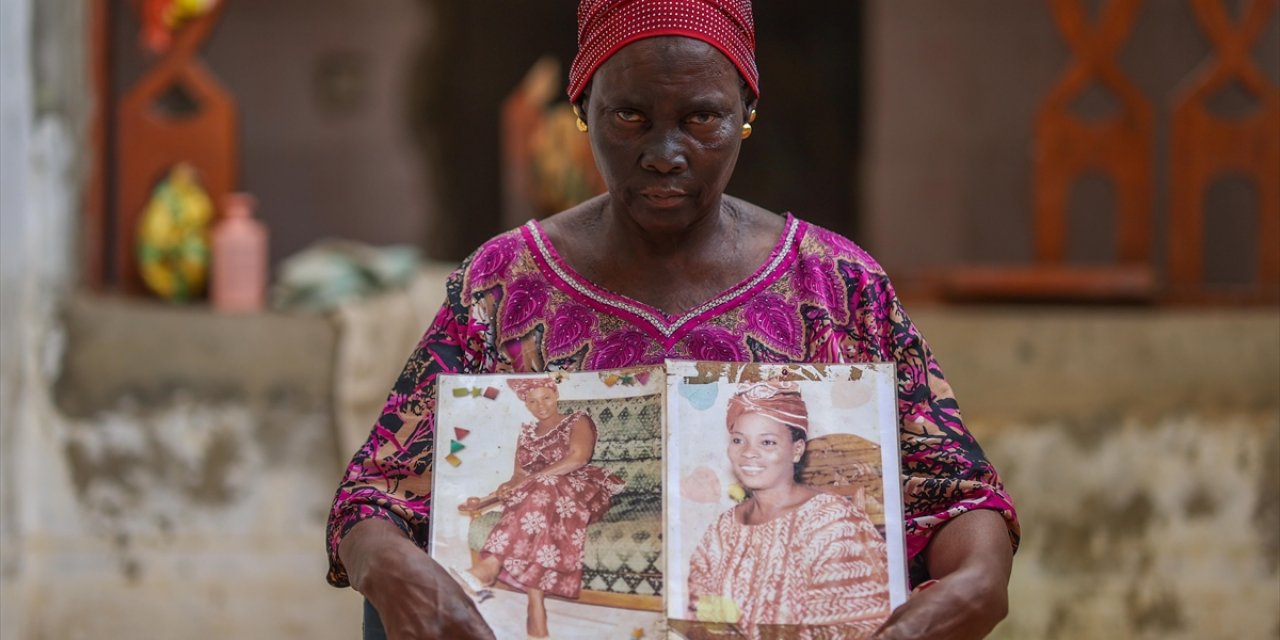 Afrika'da Cilt Beyazlatma Ürünleri Kamu Sağlığını Tehdit Ediyor