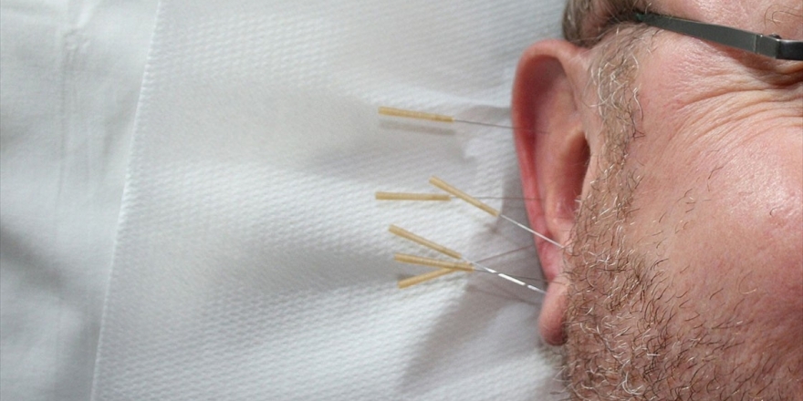 Alzaymırda Depresyona 'Akupunktur' Freni