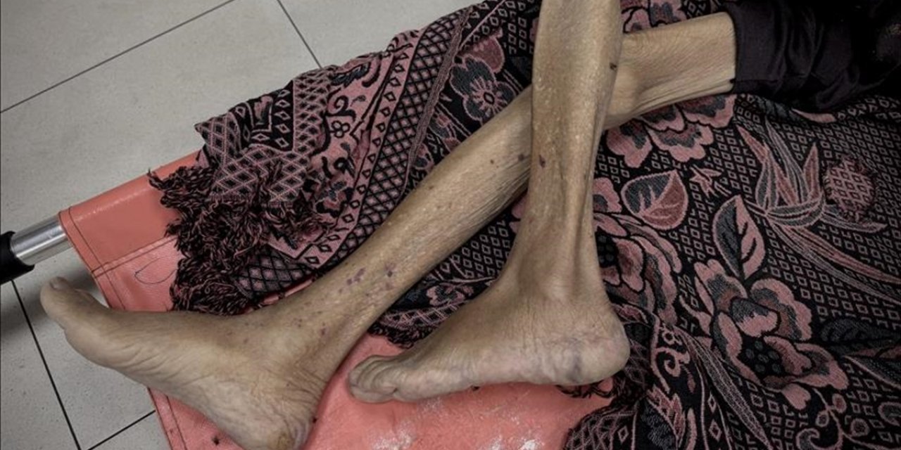 İsrail'in Kıtlığı Dayattığı Gazze'de Son 24 Saatte 3'ü Çocuk 10 Kişi Daha Açlıktan Hayatını Kaybetti