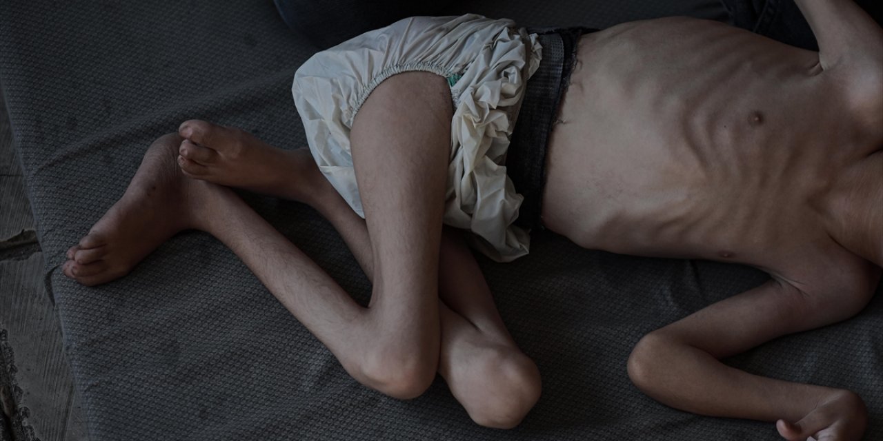 İsrail'in Kıtlığı Dayattığı Gazze'de Son 24 Saatte 1'i Çocuk 6 Kişi Daha Açlıktan Hayatını Kaybetti