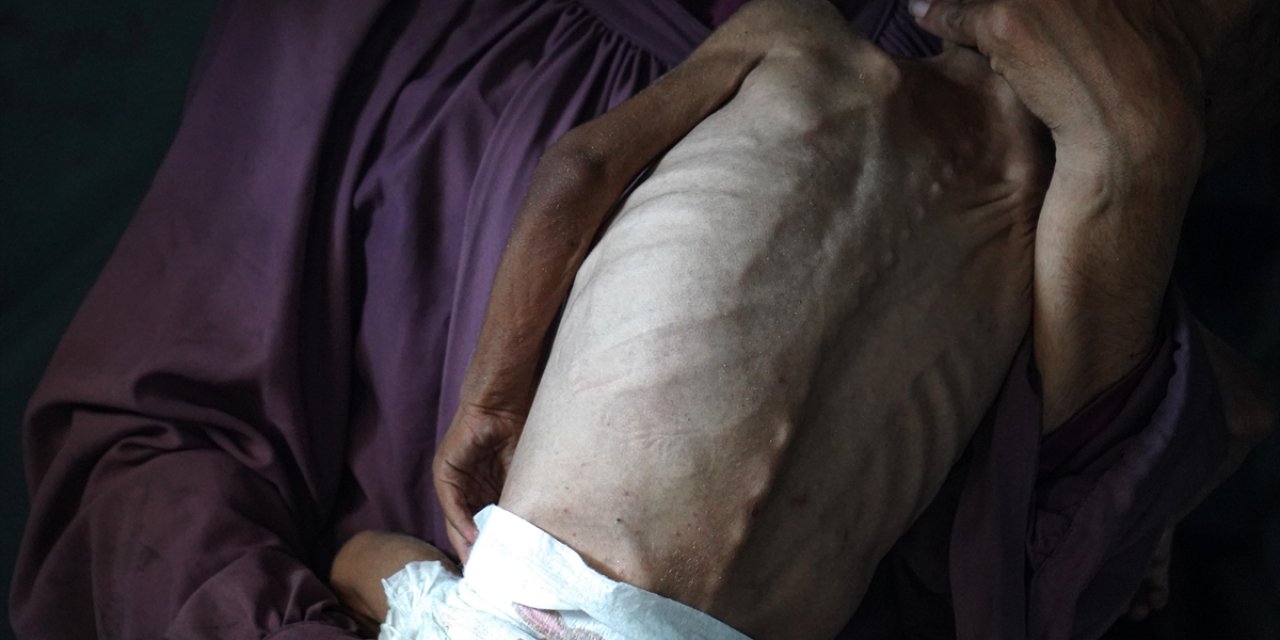 İsrail'in Kıtlığı Dayattığı Gazze'de Son 24 Saatte 1'i Çocuk 6 Kişi Daha Açlıktan Hayatını Kaybetti