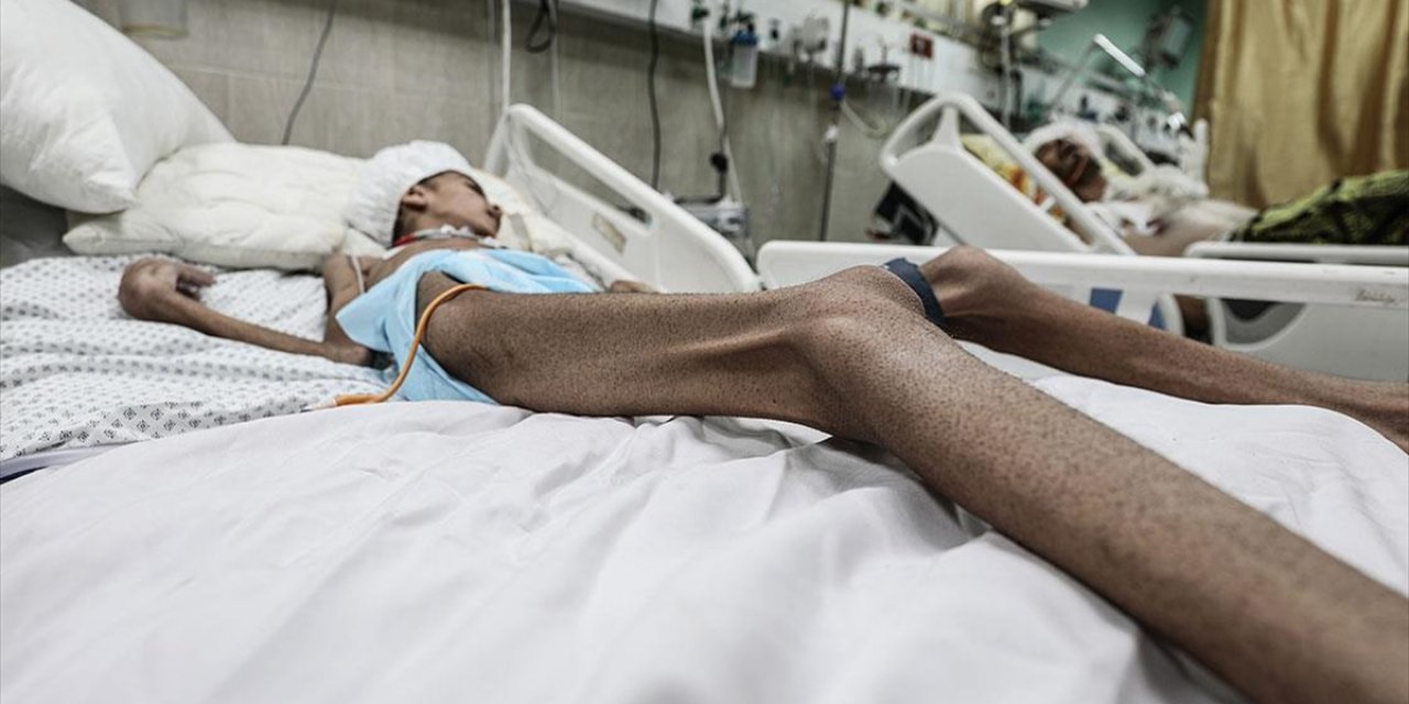 İsrail'in Kıtlığı Dayattığı Gazze'de Son 24 Saatte 6 Kişi Daha Açlıktan Hayatını Kaybetti