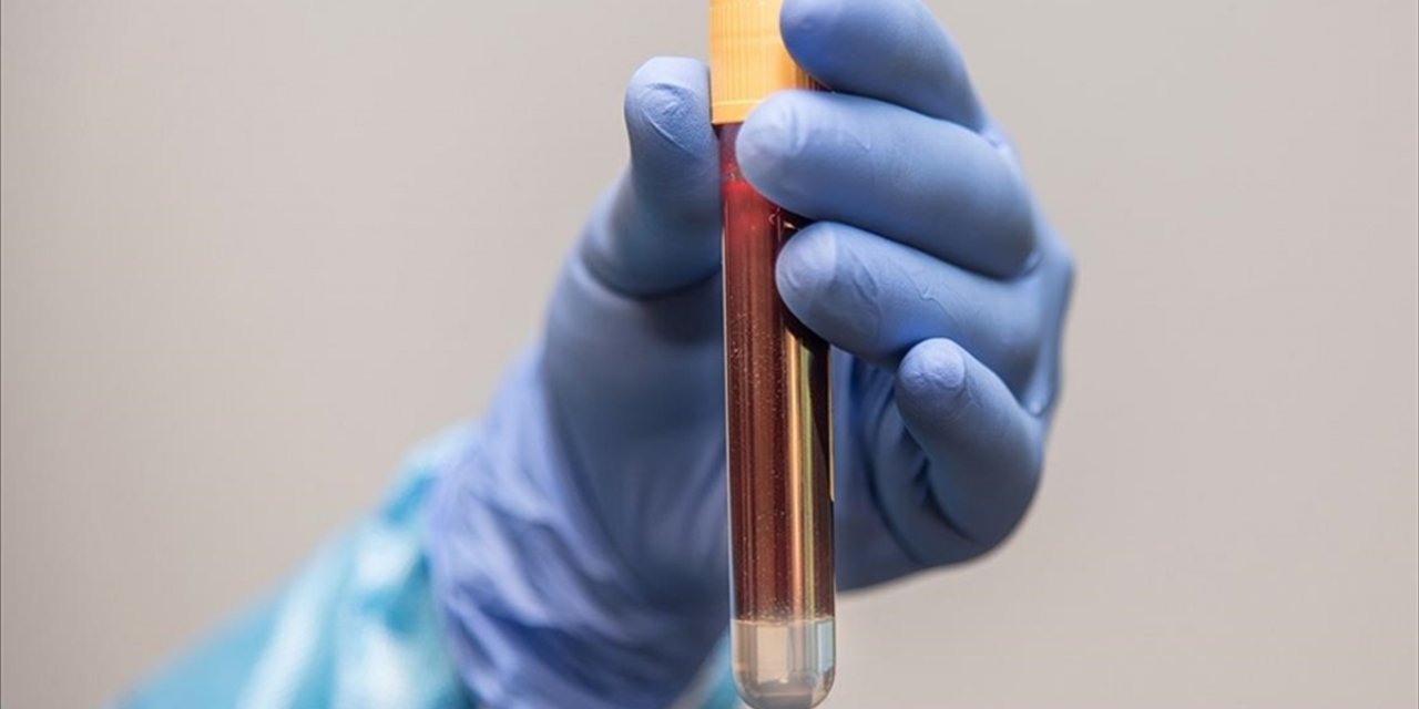 Prostat Kanserinde Erken Teşhis Hayat Kurtarıyor