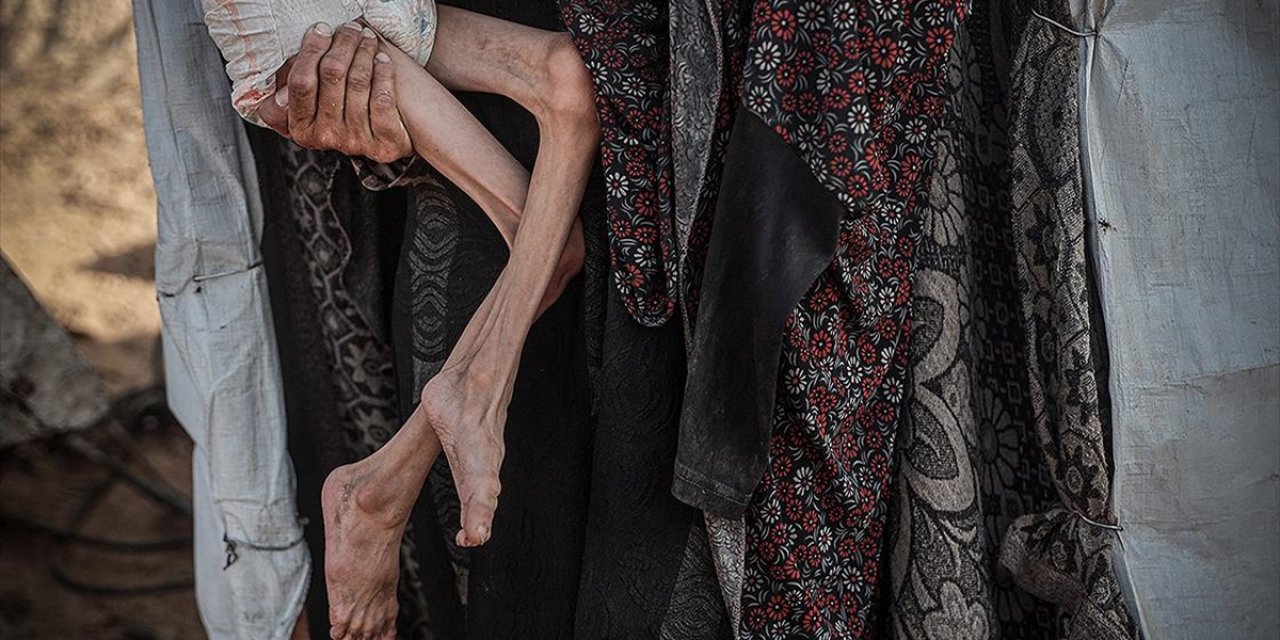 İsrail'in Kıtlığı Dayattığı Gazze'de 453 Kişi Açlıktan Hayatını Kaybetti