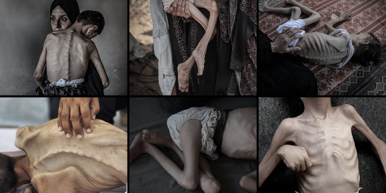 İsrail, 2 Yıldır Sürdürdüğü Soykırımda Filistinlileri Sadece Silahla Değil "Açlıkla" da Öldürüyor