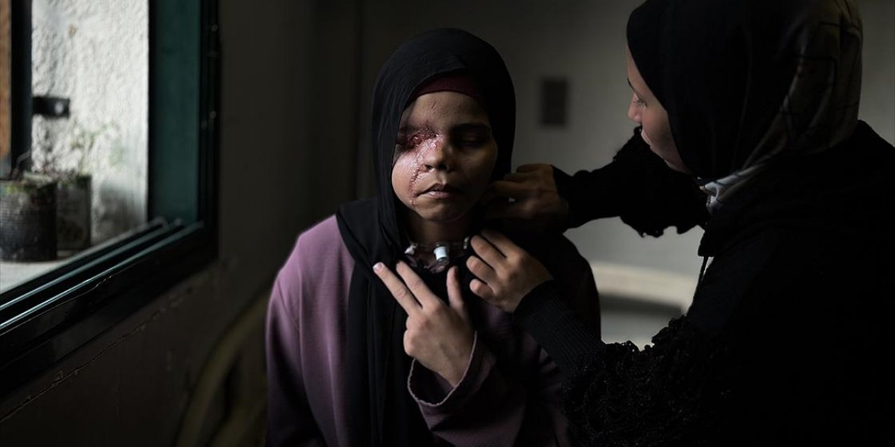 İsrail Saldırısı Nedeniyle Yüzü Tanınmaz Hale Gelen 15 Yaşındaki Gazzeli Neda'nın "Hayatı Karardı"