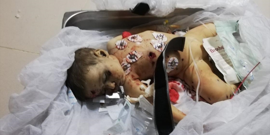 9 Aylık Muhammed Bebek Terör Örgütü Ypg/pkk'nın Kurbanı Oldu