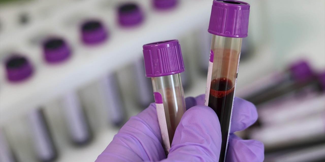 Kan Kanserinde "İmmünoterapilerle" Tedavide Yeni Dönem