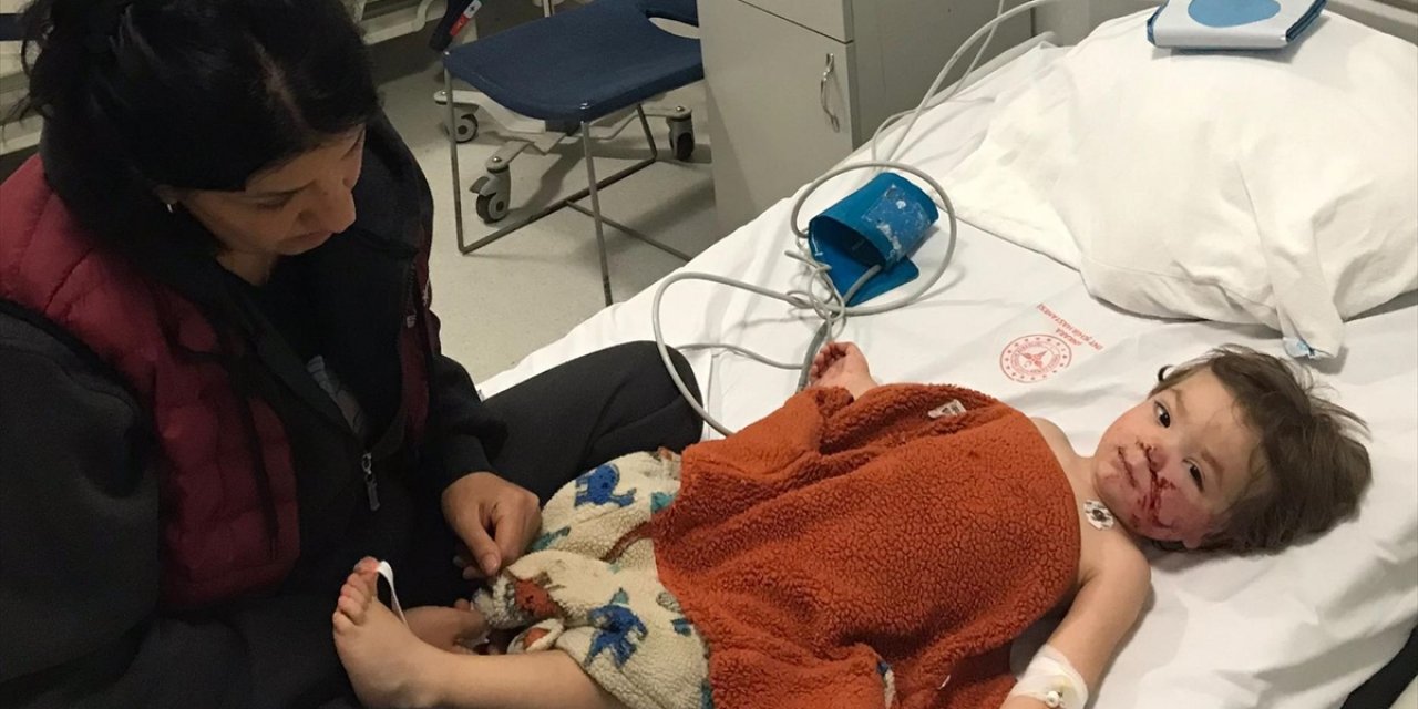 Başkentte Pitbull Cinsi Köpeğin Saldırısına Uğrayan 2 Çocuk Yaralandı