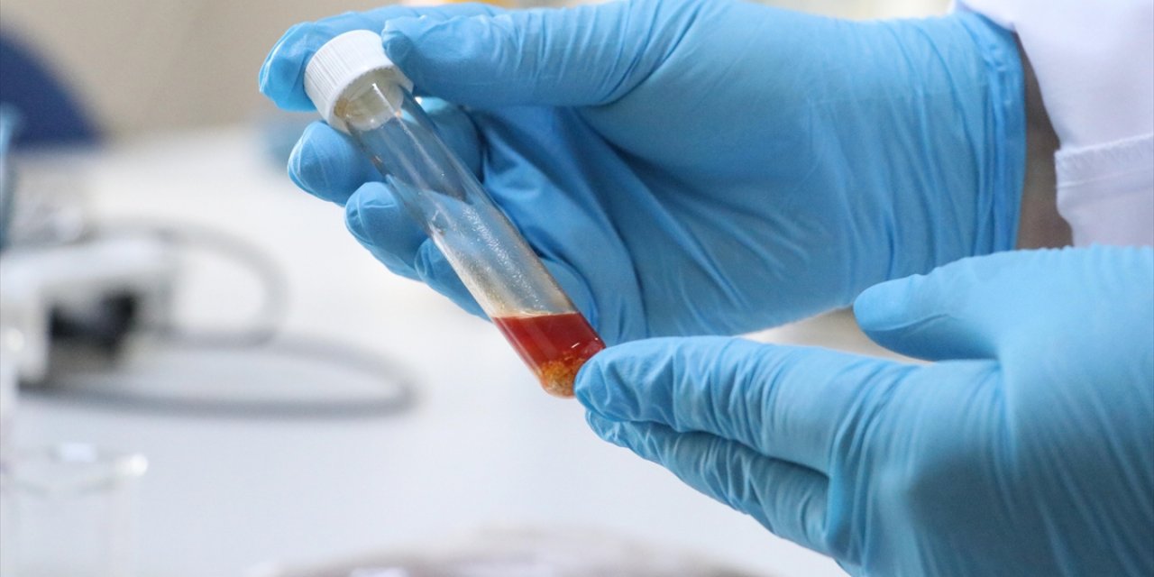 Tekirdağ'da Üzüm Atığından Yüksek Değerli Tek Hücre Yağı Üretildi