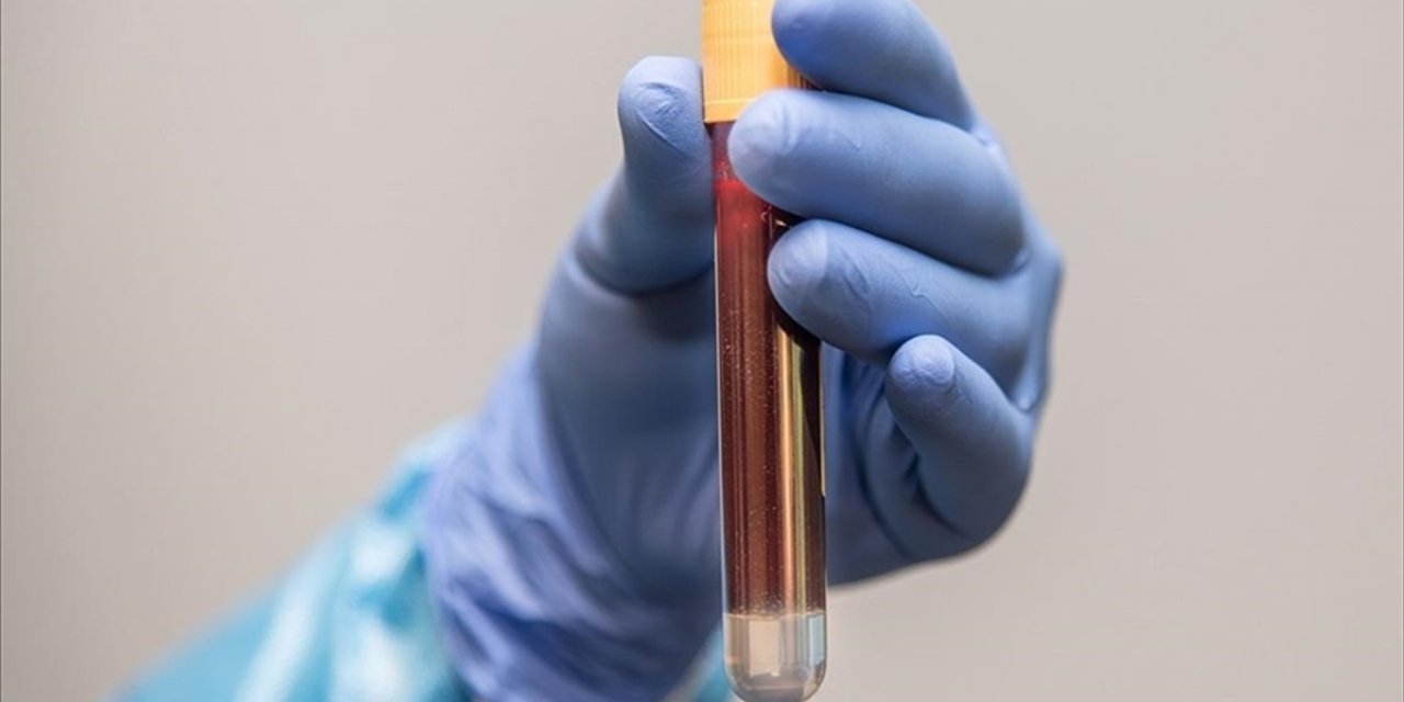 Kardeşinde Prostat Kanseri Öyküsü Olanlara 45 Yaşından İtibaren Tarama Önerisi