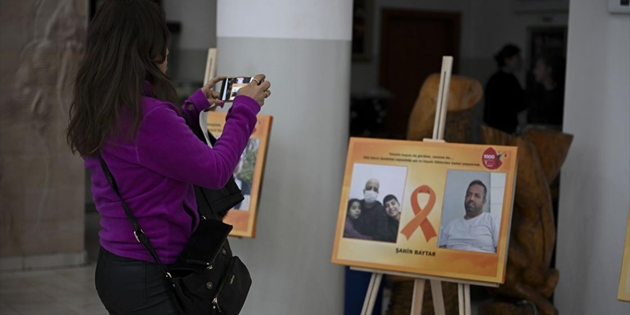 Türkiye'de Lösemi Tedavisinde Başarı Oranları Artıyor