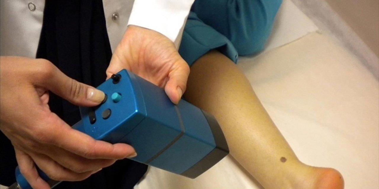 Araştırmaya Göre, Solaryuma Girmek Melanoma Yakalanma Riskini Neredeyse Üç Kat Artırıyor