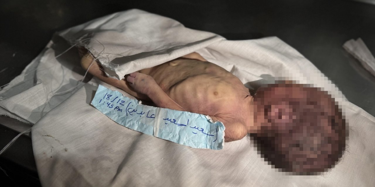 Gazze'de Şiddetli Soğuk Nedeniyle Bir Aylık Bebek Hayatını Kaybetti