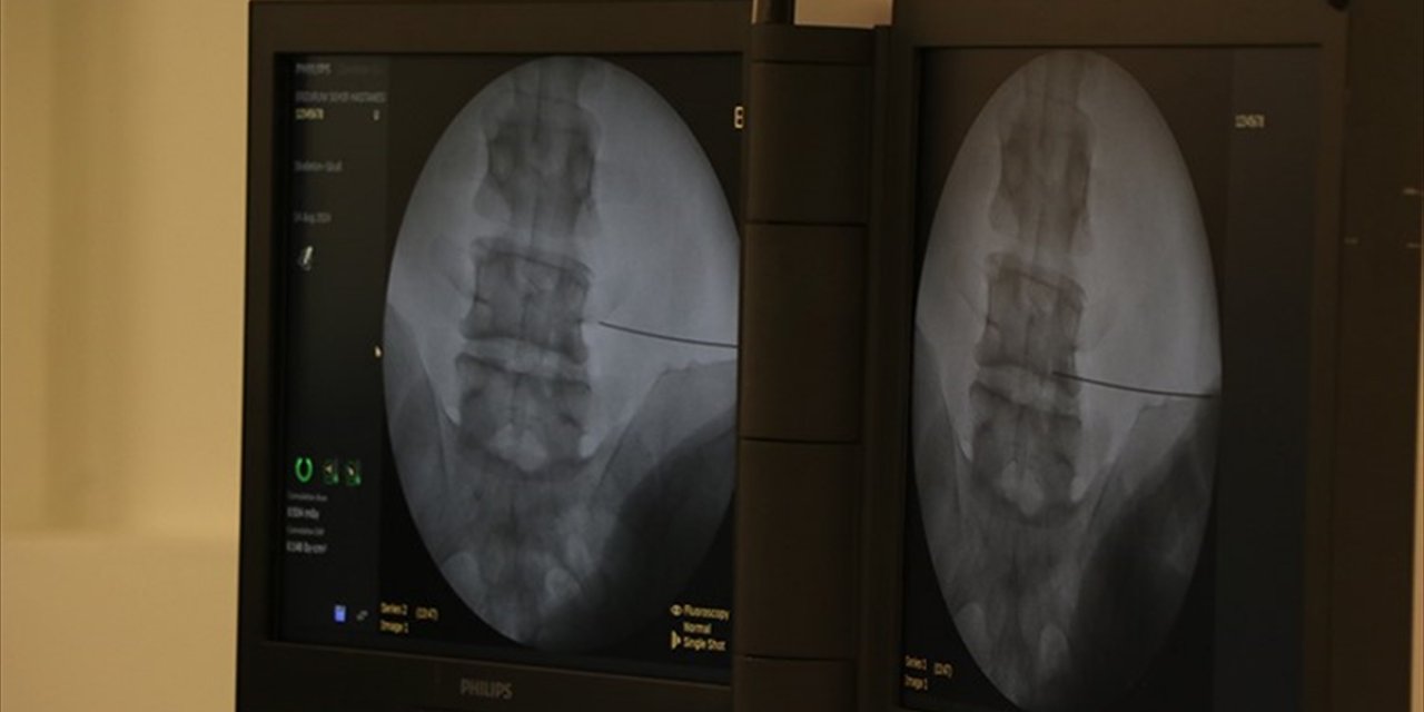 Fıtıkla Uzun Süre Yaşamak Ciddi Risklere Neden Olabiliyor