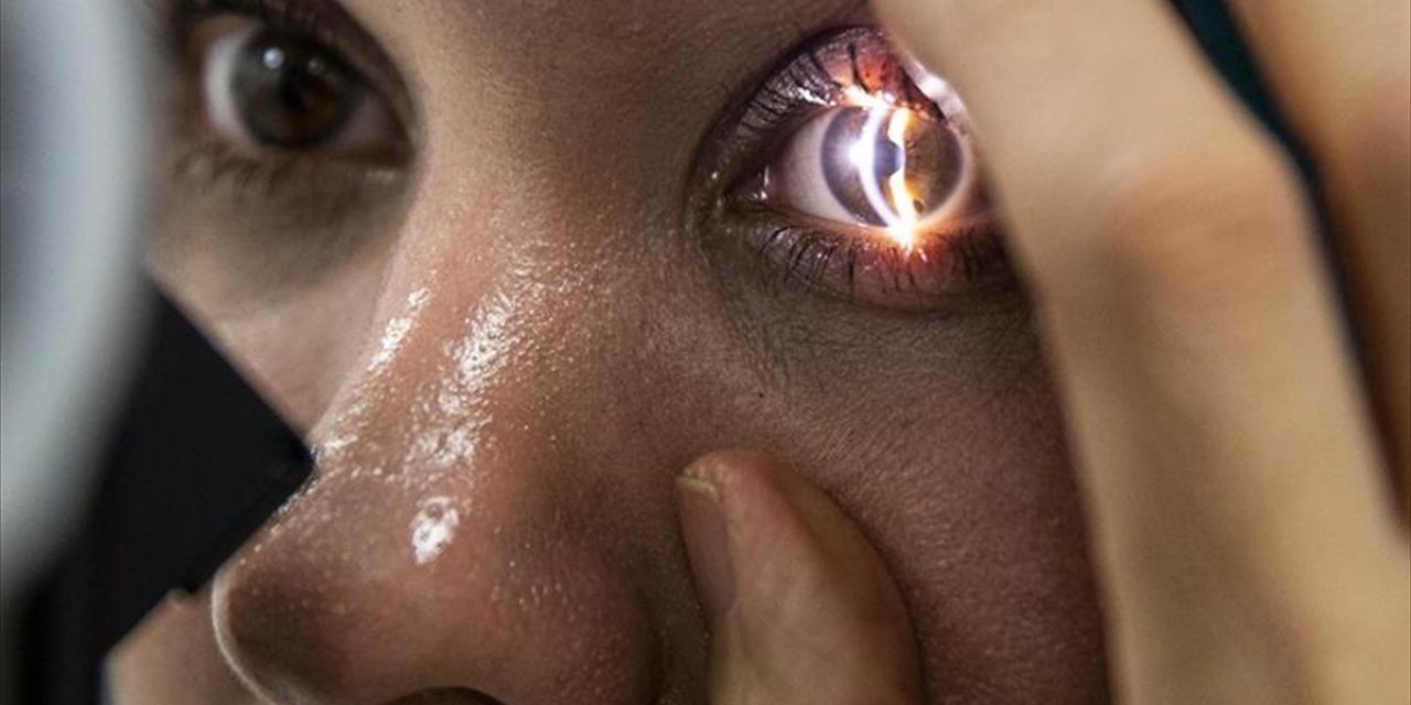 Yapay Zekaya Güvenilerek İhmal Edilen Göz Sağlığı Tedaviyi Zorlaştırıyor