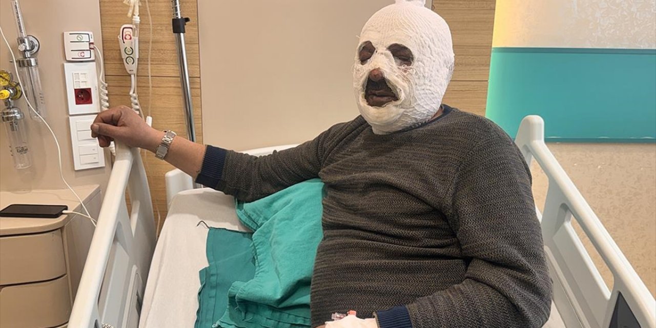 Kalorifer Kazanını Yakmak İçin Döktüğü Benzin Az Daha Canından Ediyordu