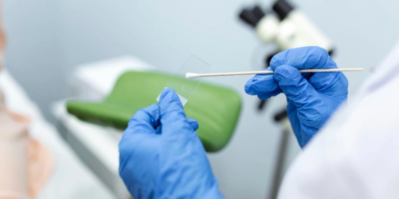 Likit Biyopsiyle Tümörün Genetik Haritası Çıkarılabiliyor