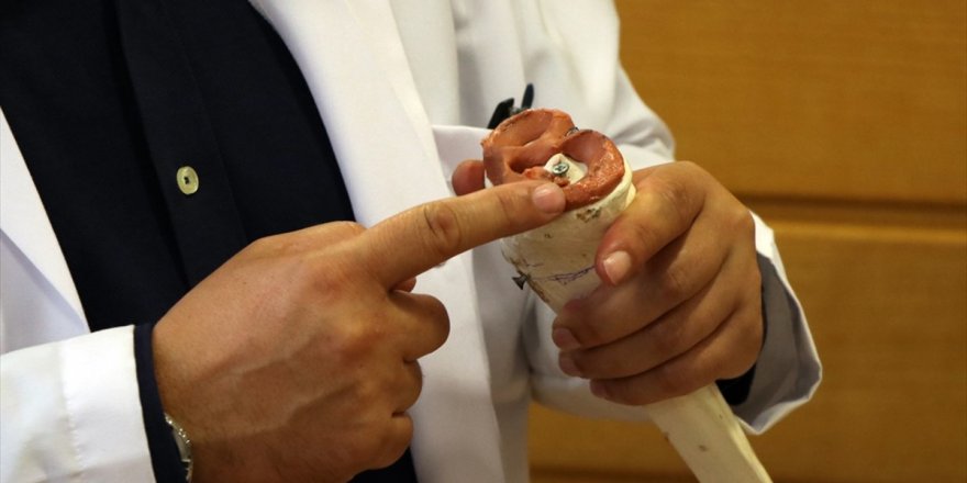 Diz Cerrahisinde Dünya Standartlarındayız