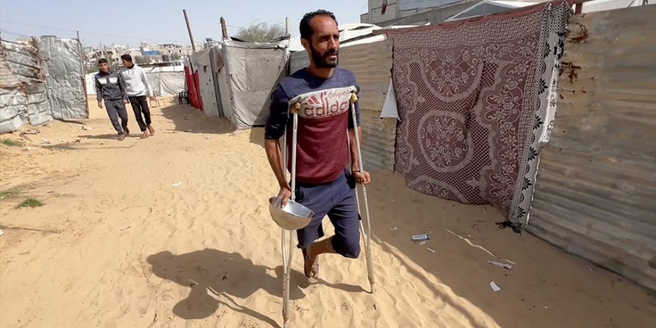 İsrail Saldırısında Bacağını Kaybeden Gazzeli Baba Engeline Rağmen Ailesi İçin Mücadelesini Sürdürüyor