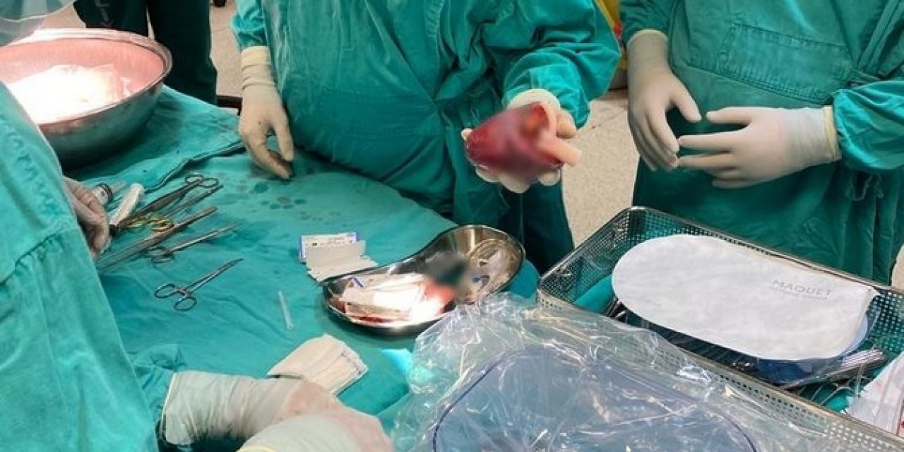 Damat "Tekrar Düşün" Baskılarına Aldırmadan Karaciğerini Kayınpederine Verdi