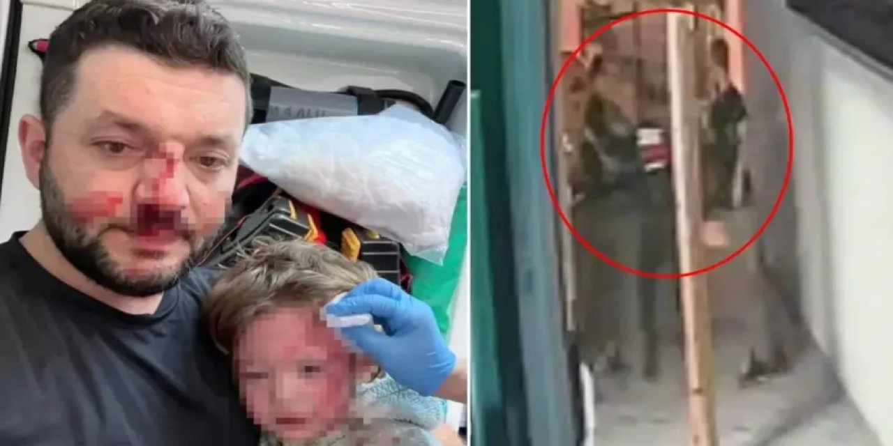 Türkiye'nin Konuştuğu Yalova'daki Saldırının Görüntüleri: 14 Aylık Bebeğin Kafatasını Çatlattılar
