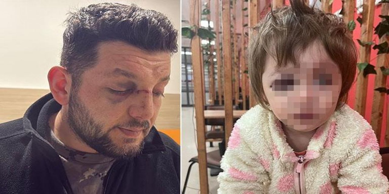 Baba Ve Kızının Yaralandığı Dava'da Karar Belli Oldu!